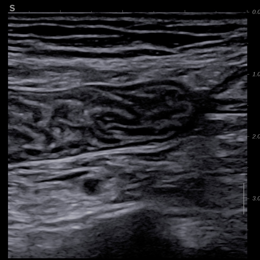 jejunum2.jpg
