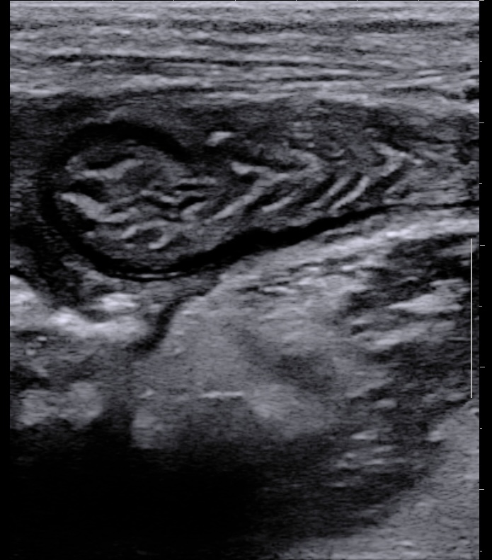 jejunum4.jpg