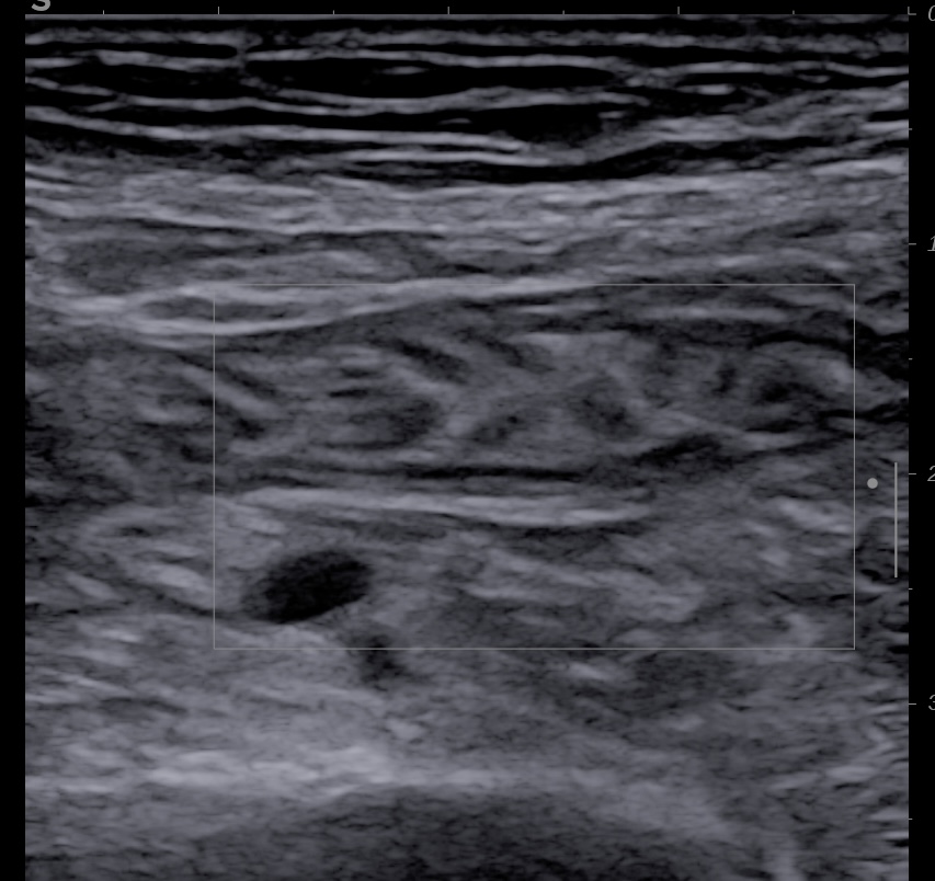 jejunum_5.jpg