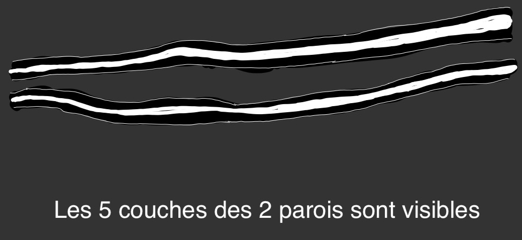 2 parois bien visibles
