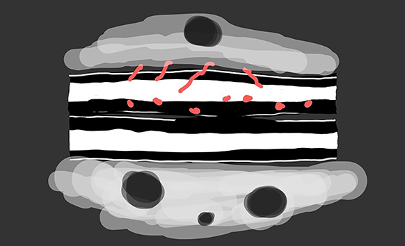 Paroi inflammée