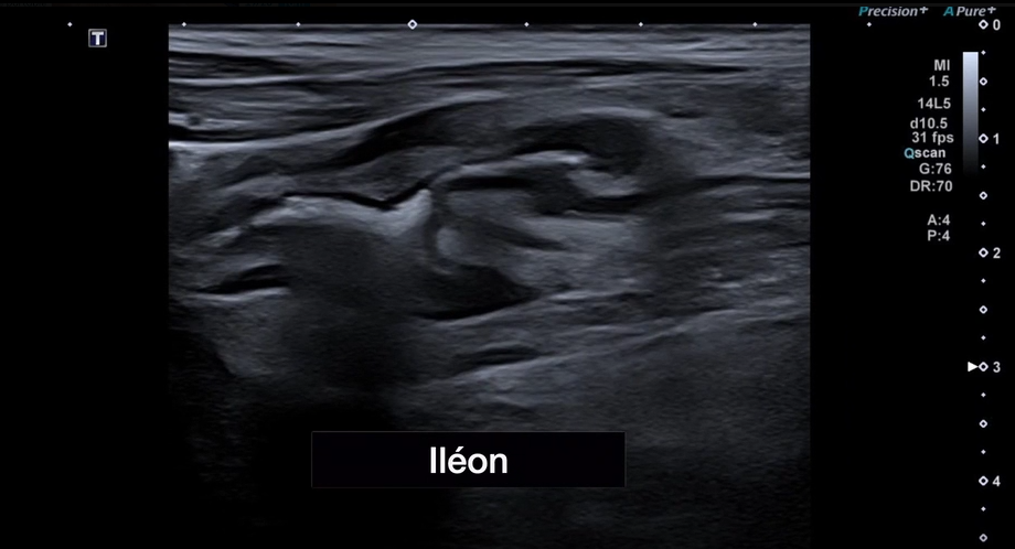IMAGE ALT TEXT